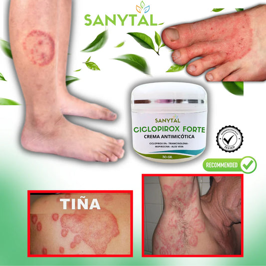 CICLOPIROX FORTE 8%- ELIMINA LA TIÑA INGUINAL